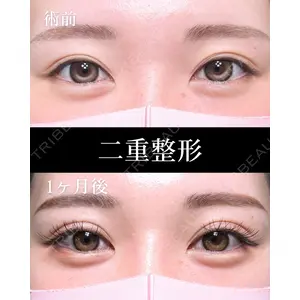 HAAB×DREAM BEAUTY CLINIC 大阪梅田院 鈴木 馨斗医師の症例