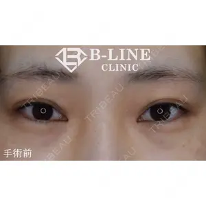 B-LINE CLINIC 池袋院 小池 康弘医師の症例