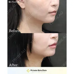 プライベートスキンクリニック 梅田本院 安形 省吾医師の症例