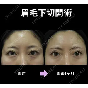 下北沢スキンクリニックの症例
