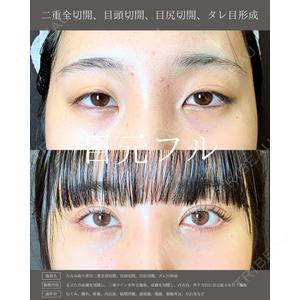eクリニック 新宿院 相原 隆充医師の症例