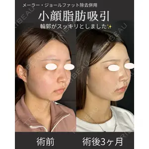 ルラ美容クリニック 仙台院 / ルラスキンクリニック 仙台院 橋本 英樹医師の症例