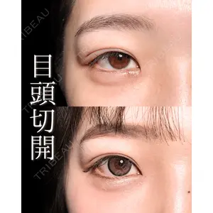 新宿美容外科ネビュラクリニック 山本 紘子医師の症例