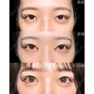 新宿美容外科ネビュラクリニック 山本 紘子医師の症例