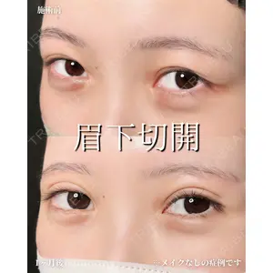 新宿美容外科ネビュラクリニック 山本 紘子医師の症例