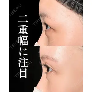 新宿美容外科ネビュラクリニック 山本 紘子医師の症例