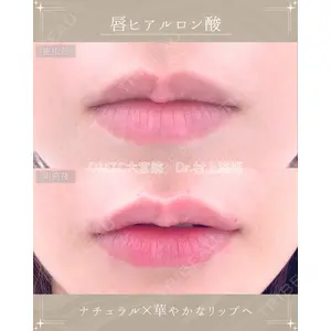 DMTC美容皮膚科 大宮院 村上医師医師の症例