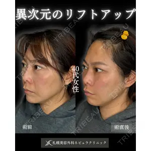 札幌美容外科ネビュラクリニック 横田 開医師の症例