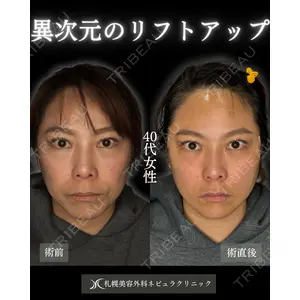 札幌美容外科ネビュラクリニック 横田 開医師の症例