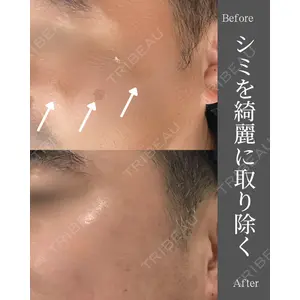 AZ BEAUTY CLINICの症例