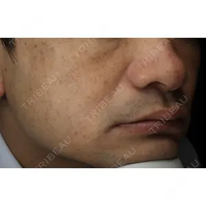 CIEL SKIN CLINIC（シエルスキンクリニック）の症例