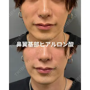 春山記念病院 山田 浩之医師の症例