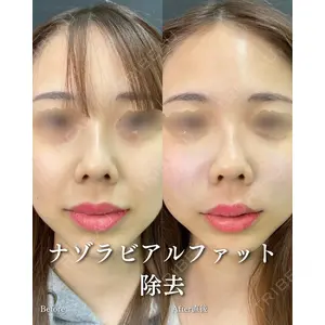 ルラ美容クリニック 渋谷本院 住友 沙織医師の症例