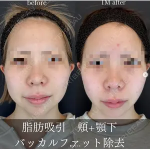 ルラ美容クリニック 大阪心斎橋院の症例