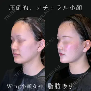 Wing clinic 豊中駅前院 速水 翼医師の症例