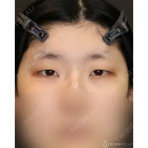 聖心美容クリニック 名古屋院 加藤 大典医師の症例