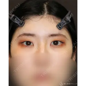 聖心美容クリニック 名古屋院 加藤 大典医師の症例