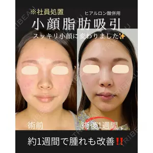 ルラ美容クリニック 仙台院 / ルラスキンクリニック 仙台院 橋本 英樹医師の症例