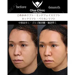 Otus Clinic 【オータスクリニック】 中 徳太郎医師の症例