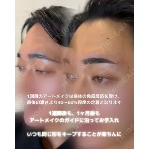 M'sクリニック【エムズクリニック】 永山　詩織（アートメイク施術者）医師の症例