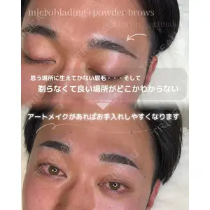 M'sクリニック【エムズクリニック】 永山　詩織（アートメイク施術者）医師の症例
