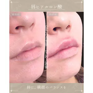 DMTC美容皮膚科 大宮院 村上医師医師の症例