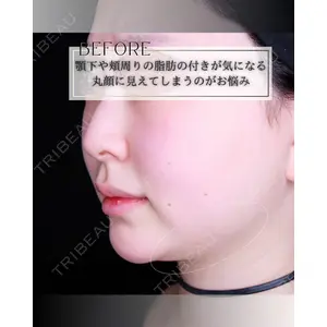 博多美容外科/美容皮膚科 ビラビューティークリニック 大村 亞蘭医師の症例