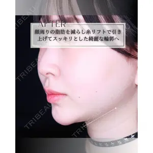博多美容外科/美容皮膚科 ビラビューティークリニック 大村 亞蘭医師の症例