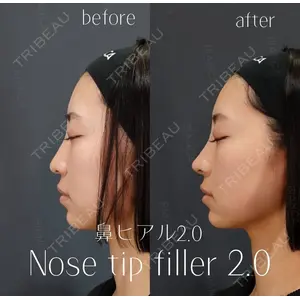 BIANCA銀座 池田 雪太郎医師の症例