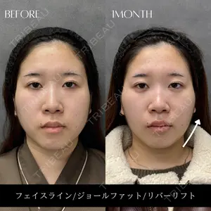 RIVER CLINIC（リバークリニック）大阪院 木家 佑理子医師の症例