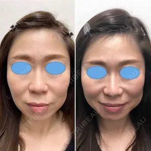 しのぶ皮膚科 蘇原しのぶ医師の症例