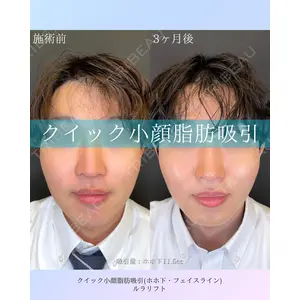 ルラ美容クリニック 札幌本院 佐藤 雄紀医師の症例