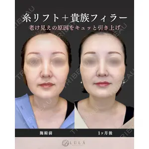 ルラ美容クリニック 名古屋栄院 / ルラスキンクリニック 名古屋栄院 関戸 優医師の症例