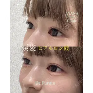 AYANAフィラーズクリニック 渋谷院 古田 晃医師の症例
