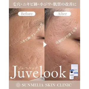 SUNMELIA SKIN CLINICの症例