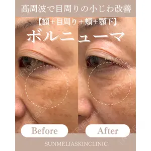 SUNMELIA SKIN CLINICの症例