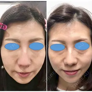 しのぶ皮膚科 蘇原しのぶ医師の症例
