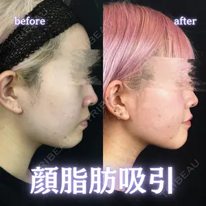 ルラ美容クリニック 新宿院 陶 美梨医師の症例