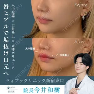 美容皮膚科ティファクリニック 新宿東口 今井 和樹医師の症例