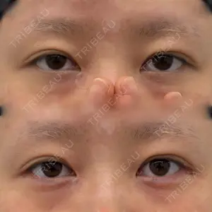 Next Tokyo Clinic 松本 俊太郎医師の症例