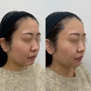 Next Tokyo Clinic 松本 俊太郎医師の症例