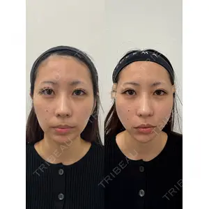 Next Tokyo Clinicの症例