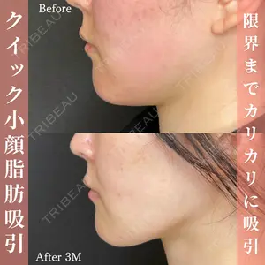 ルラ美容クリニック 名古屋本院 酒井 俊行医師の症例