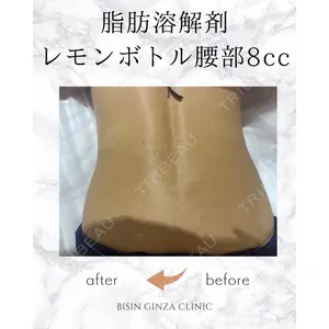 BISIN GINZA CLINICの症例