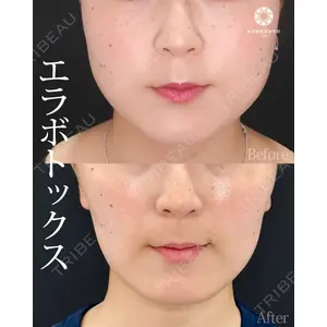 東京形成美容外科 銀座院 弓削田　浩主医師の症例