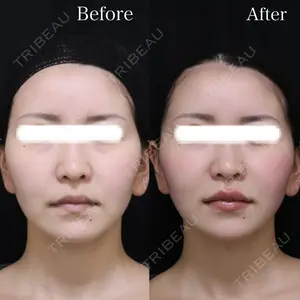 Wクリニック 福岡院 堂園 史子医師の症例