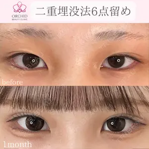 オーキッド美容クリニック東京御徒町 西浦 蘭子医師の症例