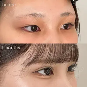 オーキッド美容クリニック東京御徒町 西浦 蘭子医師の症例