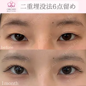 オーキッド美容クリニック東京御徒町 西浦 蘭子医師の症例