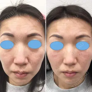 しのぶ皮膚科 蘇原しのぶ医師の症例